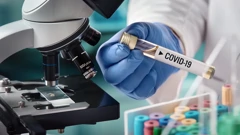 Nova 64 slučaja koronavirusa, pet osoba umrlo
