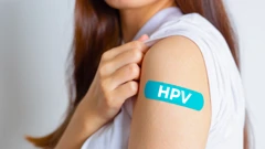 Cijepljenje protiv HPV-a