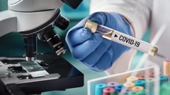 Koronavirus: 46 novooboljelih, šest preminulih