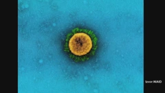 Češki soj koronavirusa