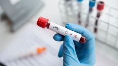 Pandemija i HIV